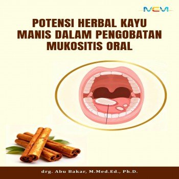 POTENSI HERBAL KAYU MANIS DALAM PENGOBATAN MUKOSITIS ORAL